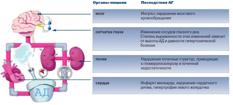 Что такое гипертонический криз — симптомы и первая помощь, осложнения