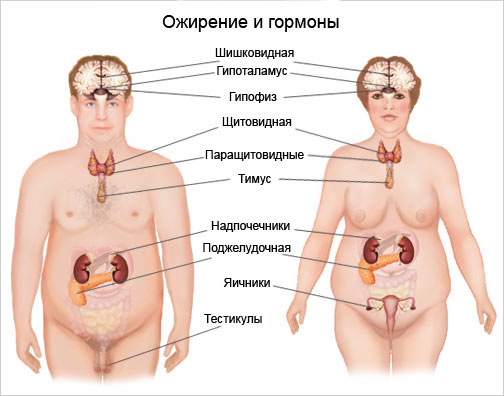 Что такое ожирение: причины, степени ожирения, лечение