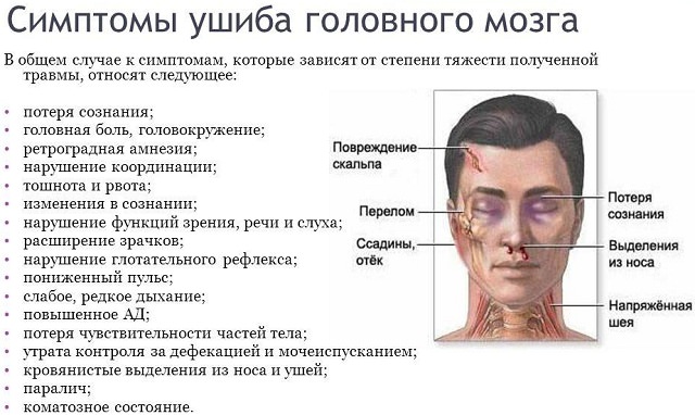 Что такое сотрясение головного мозга — симптомы и лечение, последствия