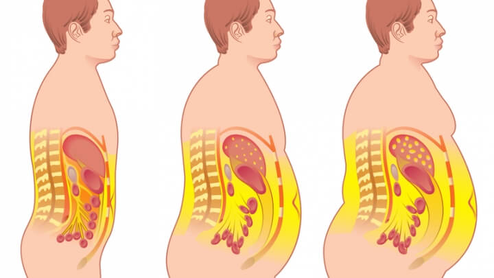 Что такое висцеральный жир — как избавиться, нормы абдоминального жира