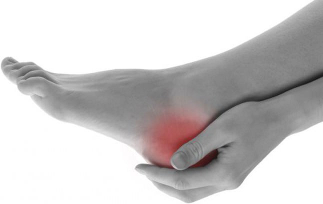 Деформация хаглунда &mdash; причины, симптомы, лечение