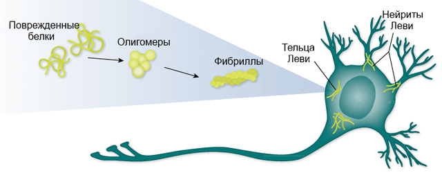 Деменция с тельцами леви височно-лобная, причины и симптомы