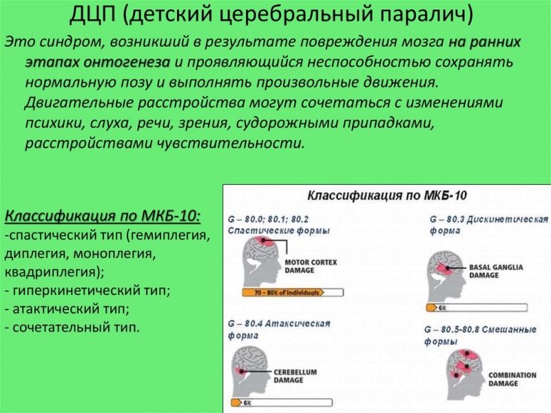 Детский церебральный паралич: 7 ранних признаков, 4 линии терапии