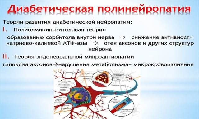 Полинейропатия нижних конечностей код