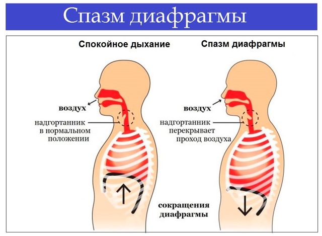 Диафрагмальный нерв, большой затылочный и ушной, анатомия