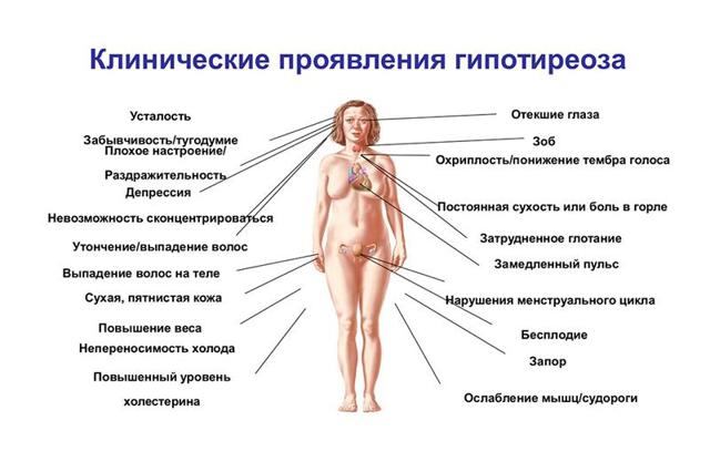 Диагностика гипотиреоза: признаки гипотиреоза у женщин и мужчин, клиника гипотиреоза, диета при гипотиреозе