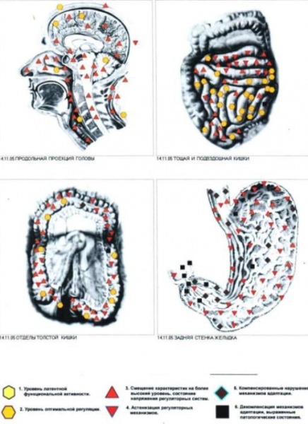 Диагностика врт, что в методе твоем? (отзыв)