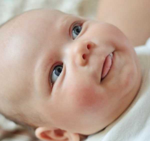 Диатез у детей, меры профилактики, народное лечение