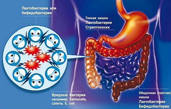 Дисбактериоз кишечника: симптомы, лечение, восстановление микрофлоры
