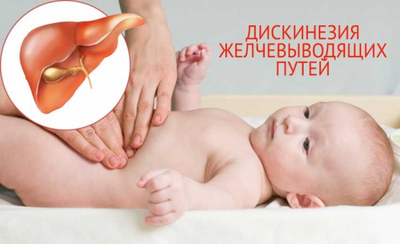 Дискинезия желчевыводящих путей у детей: 4 причины, симптомы, 3 пути лечения