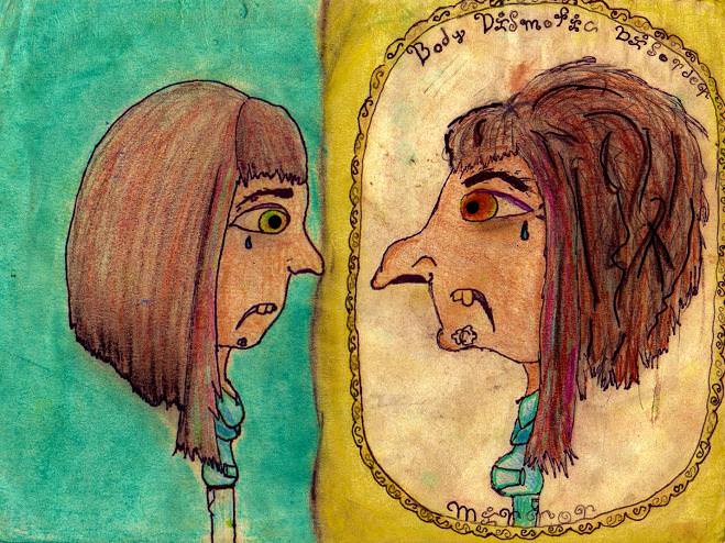 Дисморфофобия — синдром дисморфофобии