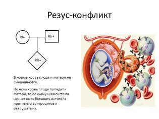 Дизартрия у детей симптомы, лечение и прогноз речи ребенка