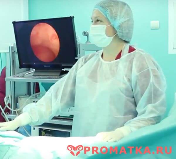 Для чего и как проводят при менопаузе гистероскопию матки?