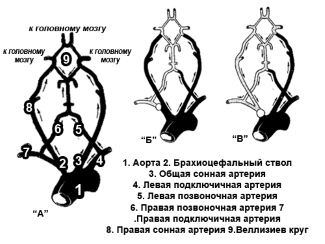 Энцефаломаляция головного мозга: сущность, диагностика и лечение