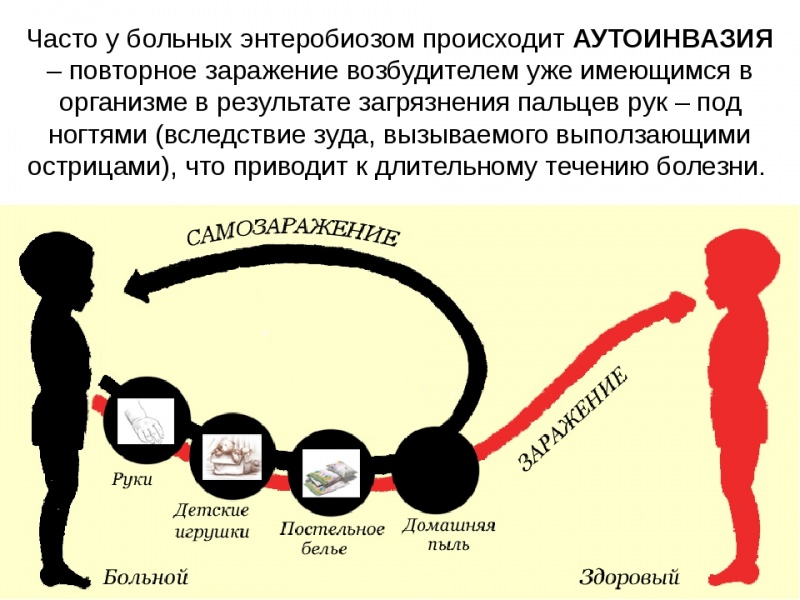 Энтеробиоз — симптомы и лечение в взрослых и детей, профилактика, осложнения