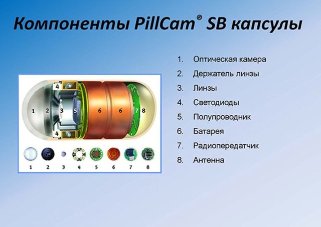 Эзофагоскопия, гастроскопия, дуоденоскопия, капсульная эндоскопия и колоноскопия