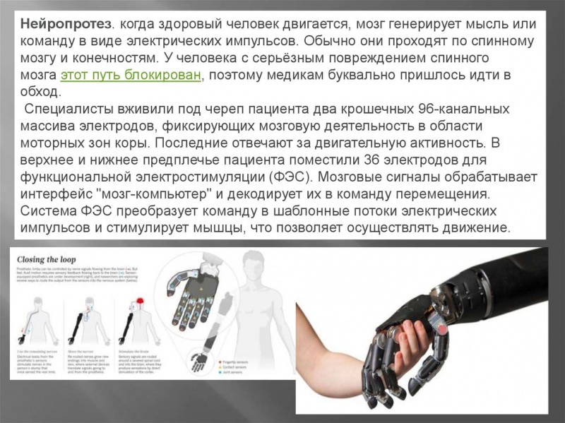 Фиксация позвонков с помощью микрочипа