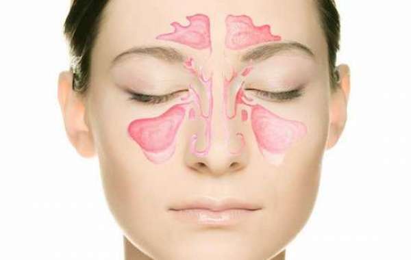 Гайморит: причины, симптомы и лечение