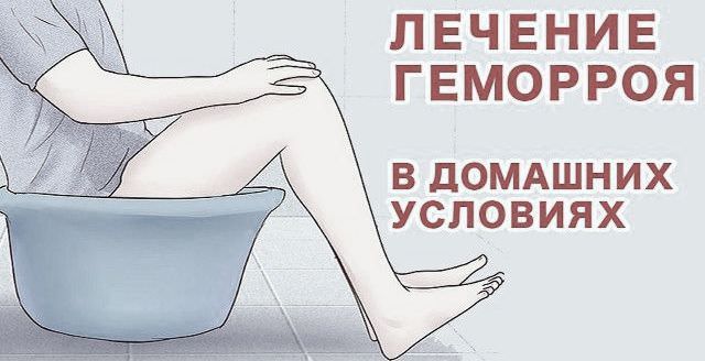 Геморрой лечение народными средствами или как лечить геморрой в домашних условиях / народная медицина