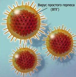 Герпетический энцефалит головного мозга у детей, симптомы новорожденных