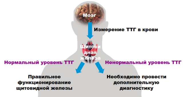 Гипоплазия щитовидной железы: лечение, признаки гипоплазии щитовидной железы у детей и взрослых