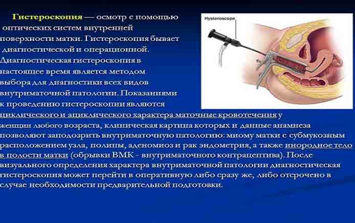 Гистероскопия матки диагностическая, осложнения