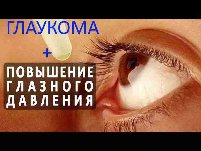 Глаукома народные средства / народная медицина / народные рецепты