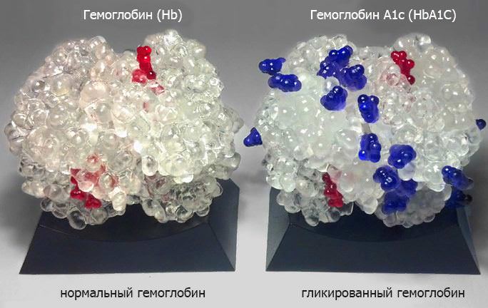 Гликированный гемоглобин — что показывает, как сдавать правильно, норма