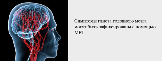 Глиоз головного мозга, что это такое, прогноз жизни, очаги в белом веществе