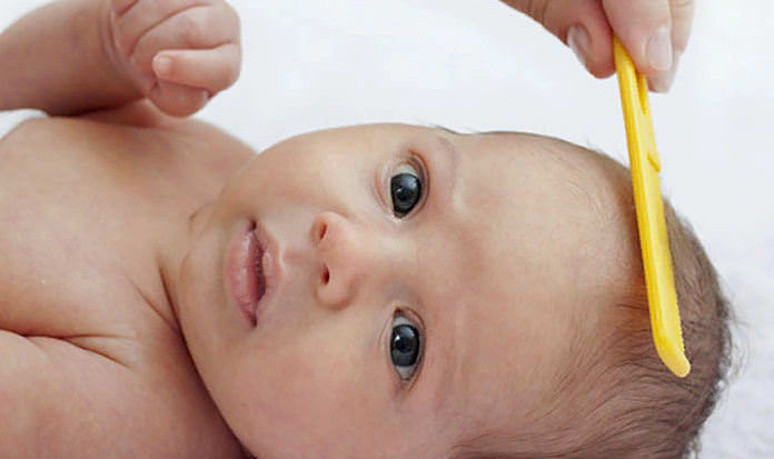 Гнейс у новорожденных, обработка головы при гнейсе, фото