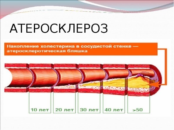 Головные боли без причины: почему болит голова и как снять головную боль без таблеток? 