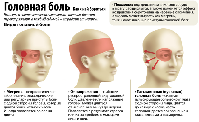 Головные боли при вегето-сосудистой дистонии