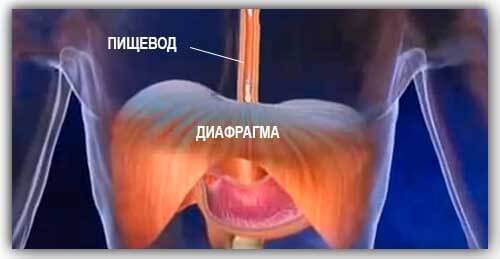 Грыжа пищевода &mdash; симптомы, лечение, осложнения, диета