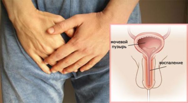 Хламидийный уретрит у мужчин и женщин: источник инфекции, характерные симптомы, методы обследования и лечения