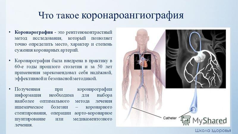 Холтеровское мониторирование: все, что вы хотели знать о процедуре