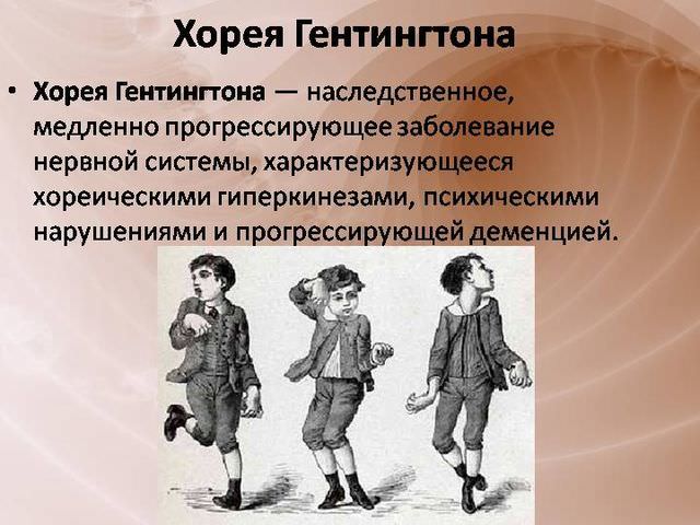 Хорея гентингтона: причины болезни, симптомы синдрома у детей