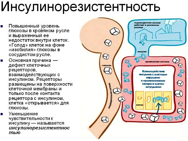 Инсулиновая резистентность &mdash; что это, симптомы, причины, лечение, диета