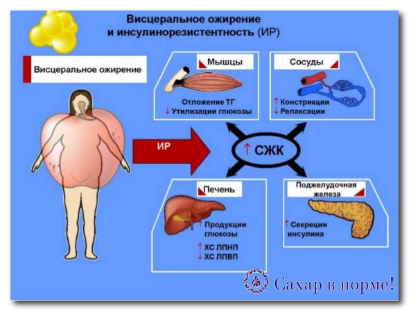Инсулиновая резистентность &mdash; что это, симптомы, причины, лечение, диета