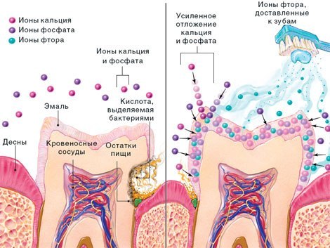 Как бороться с повышенной чувствительностью зубов: причины повышенной чувствительности зубов и методы их устранения