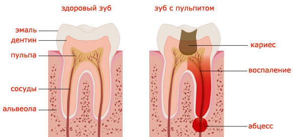 Как бороться с повышенной чувствительностью зубов: причины повышенной чувствительности зубов и методы их устранения