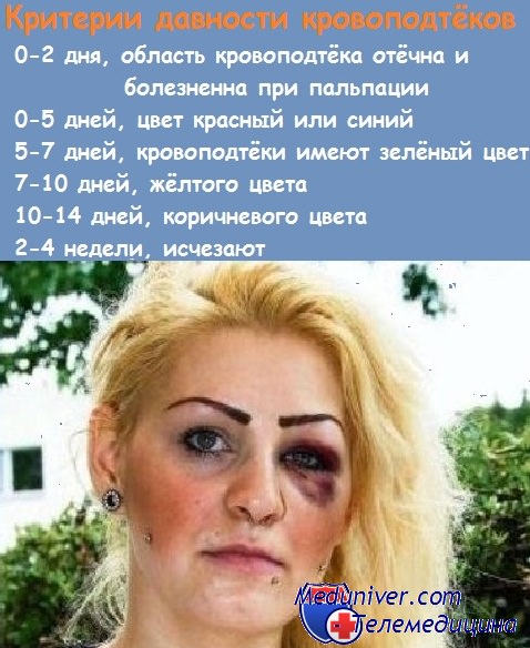 Как быстро убрать синяк под глазом — лечение кровоподтека