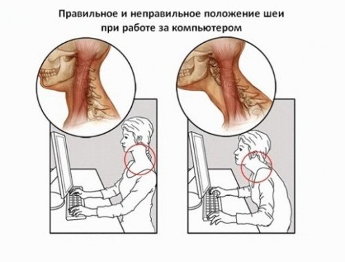 Как избавить от боли в шее и какие могут быть причины боли в шее