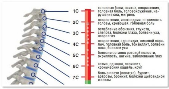 Как избавить от боли в шее и какие могут быть причины боли в шее