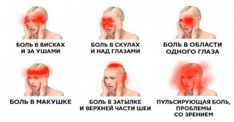 Как избавиться от головной боли без таблеток, причины