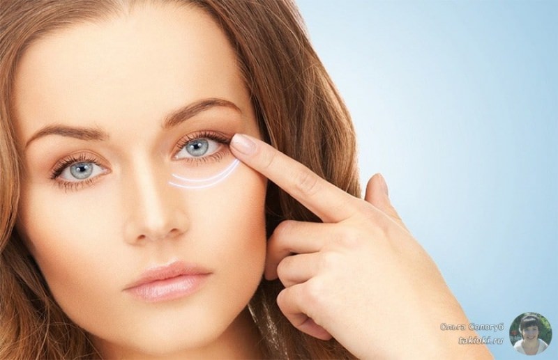 Как избавиться от мешков под глазами &mdash; убрать быстро
