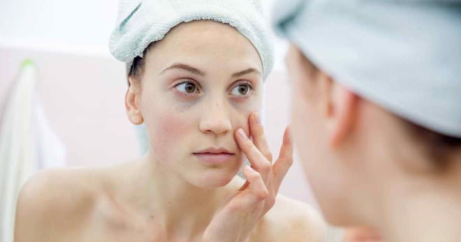 Как избавиться от мешков под глазами &mdash; убрать быстро