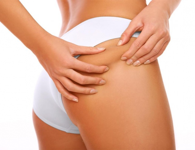 Как избавиться от растяжек? салонные и домашние способы