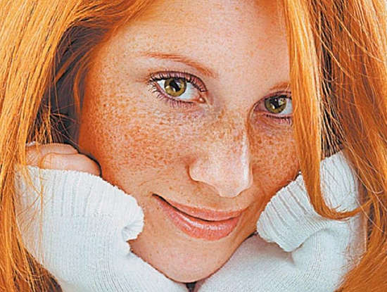 Как избавиться от веснушек на лице, теле, ошибки при их выведении
