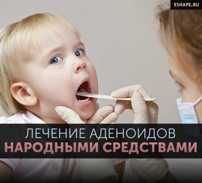 Как лечить аденоиды дома — аденоиды и народная медицина