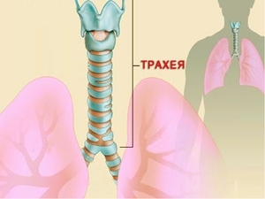 Как лечить кашель ребенка при трахеите?